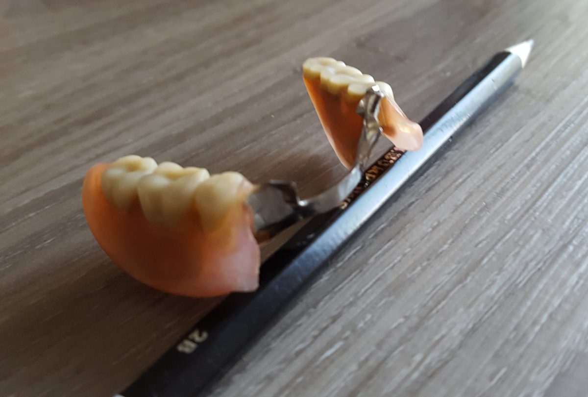 A broken partial denture next to a pencil